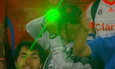 laser hincha