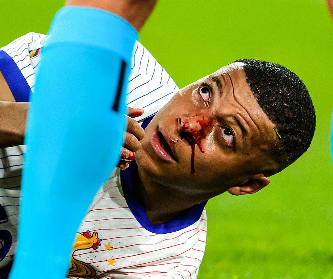 Kylian Mbappe francia