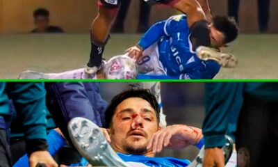 zampedri lesion